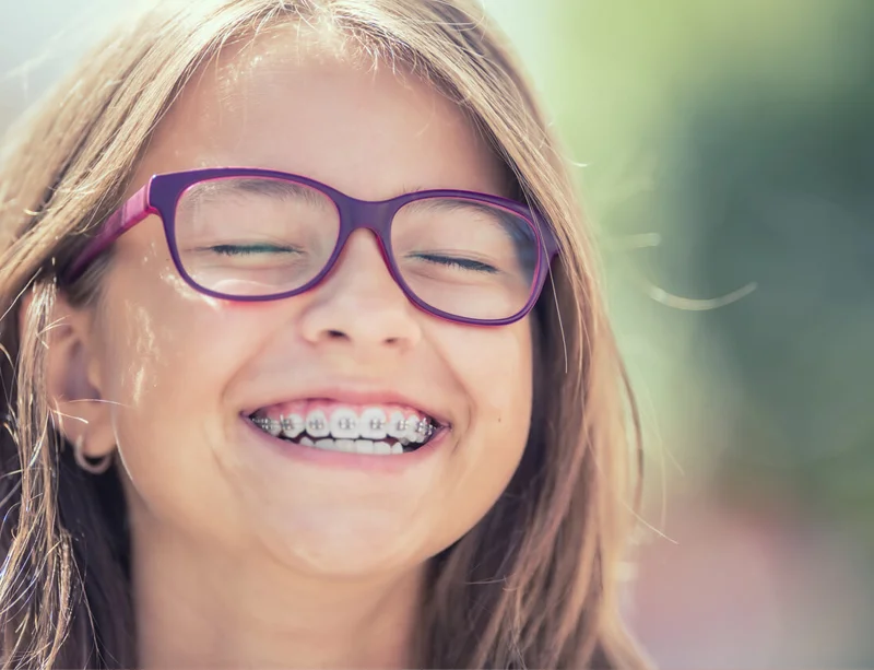 Dental Braces
